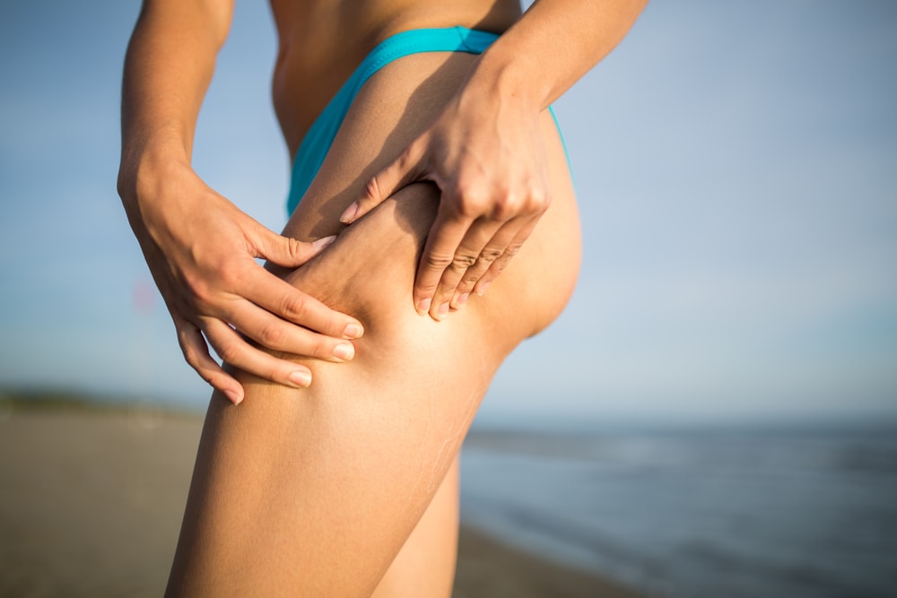 4 Awesome Treatments That Say Goodnight To Your Cellulite
