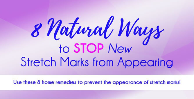 8 NATURAL WAYS TO STOP NEW STRETCH MARKS FROM APPEARING