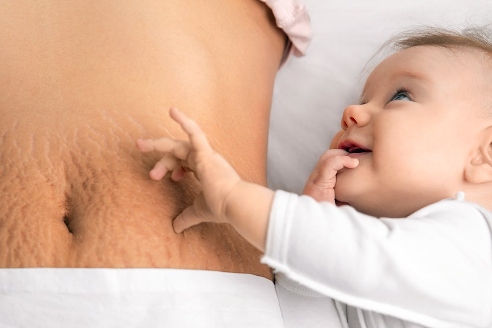 How to shrink your postpartum pouch & get your prepartum confidence back...even if you gave birth years ago!